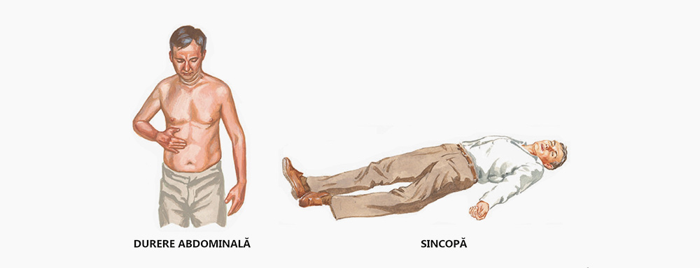 femeie durere abdominala.jpg