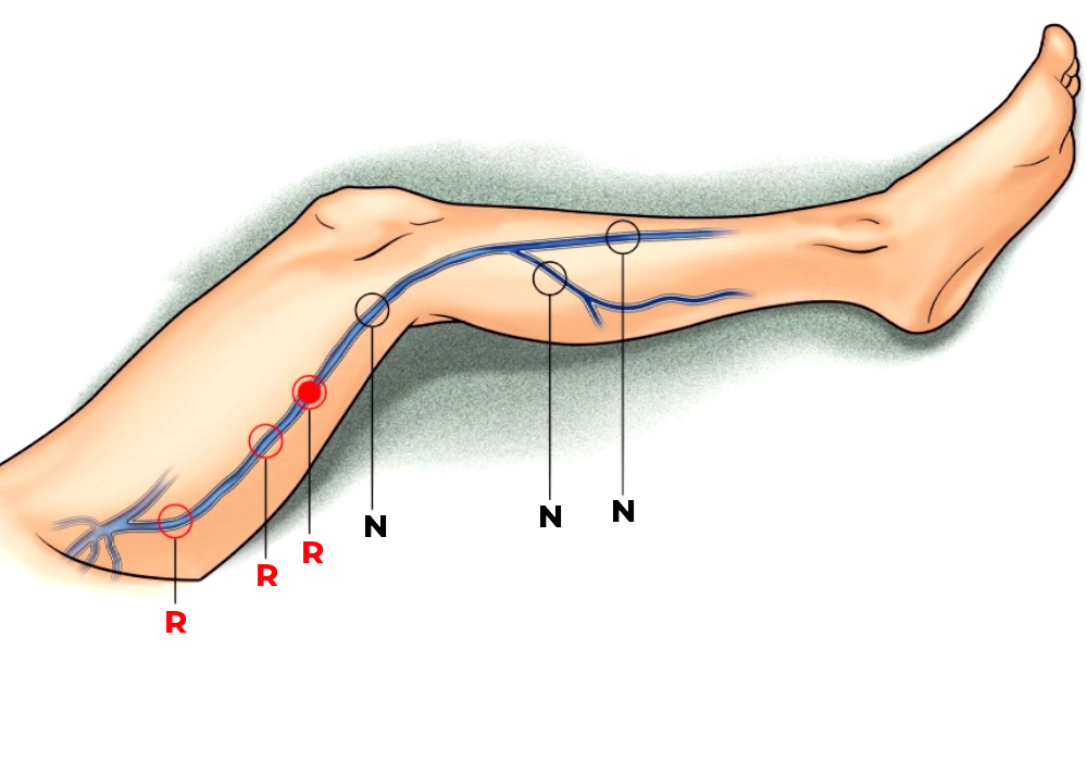 Cura Hemodinamica