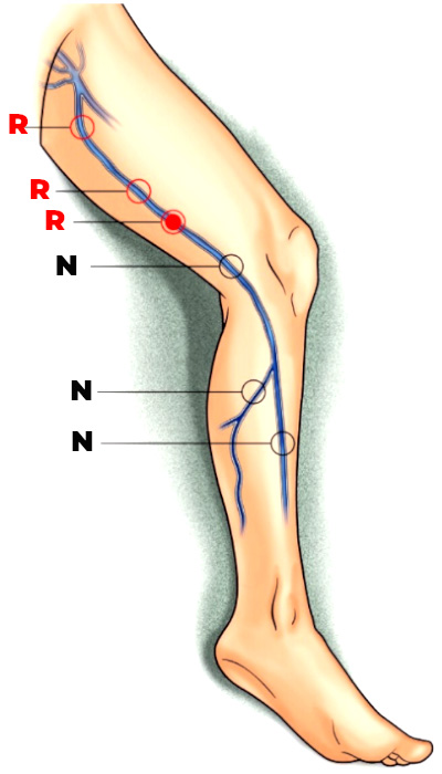 Cura Hemodinamică